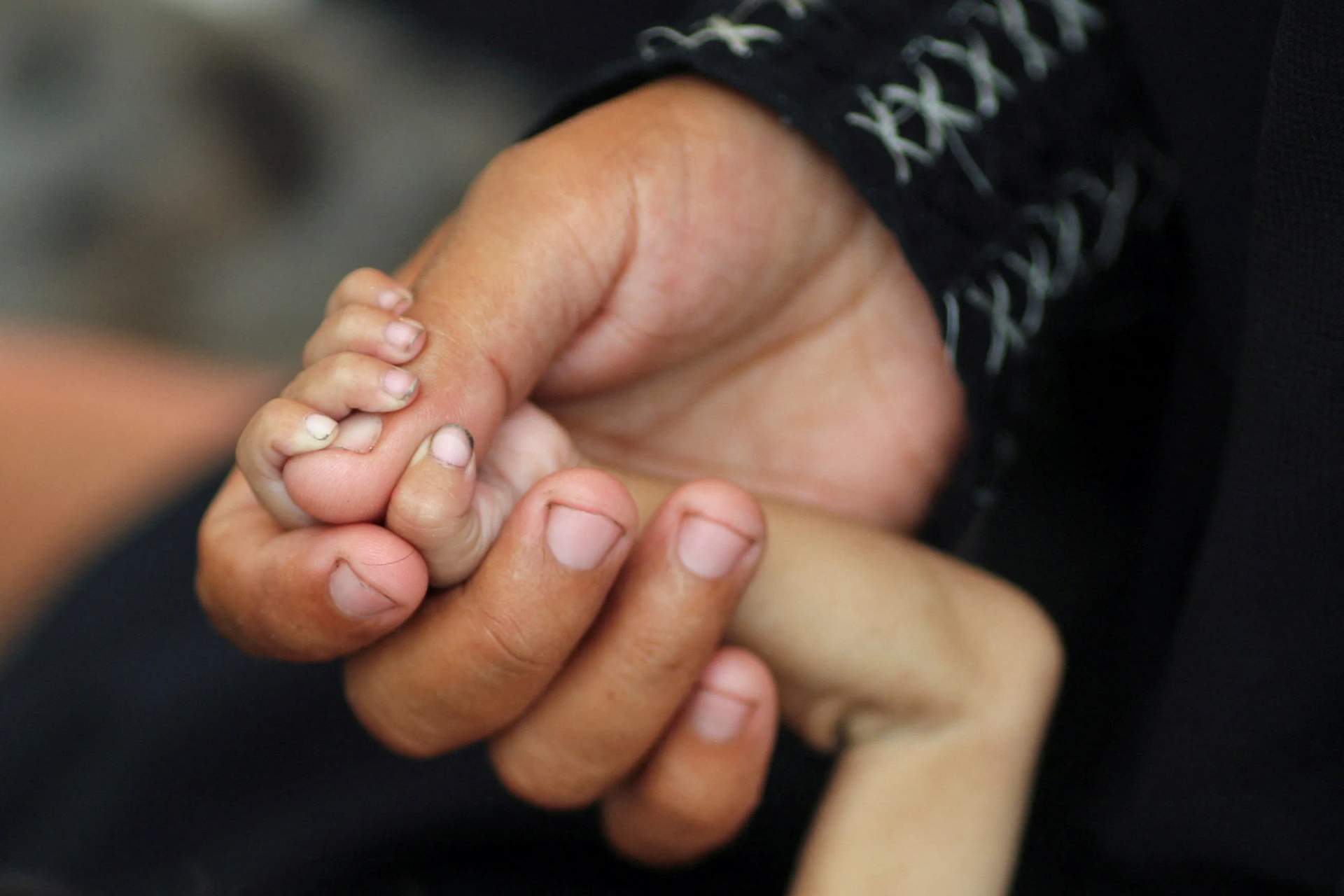 Palestinian mother cradling a severely malnourished five-month-old infant in a hospital in Gaza City during famine