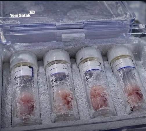 4 Embryos in tubes in a cryogenic case
