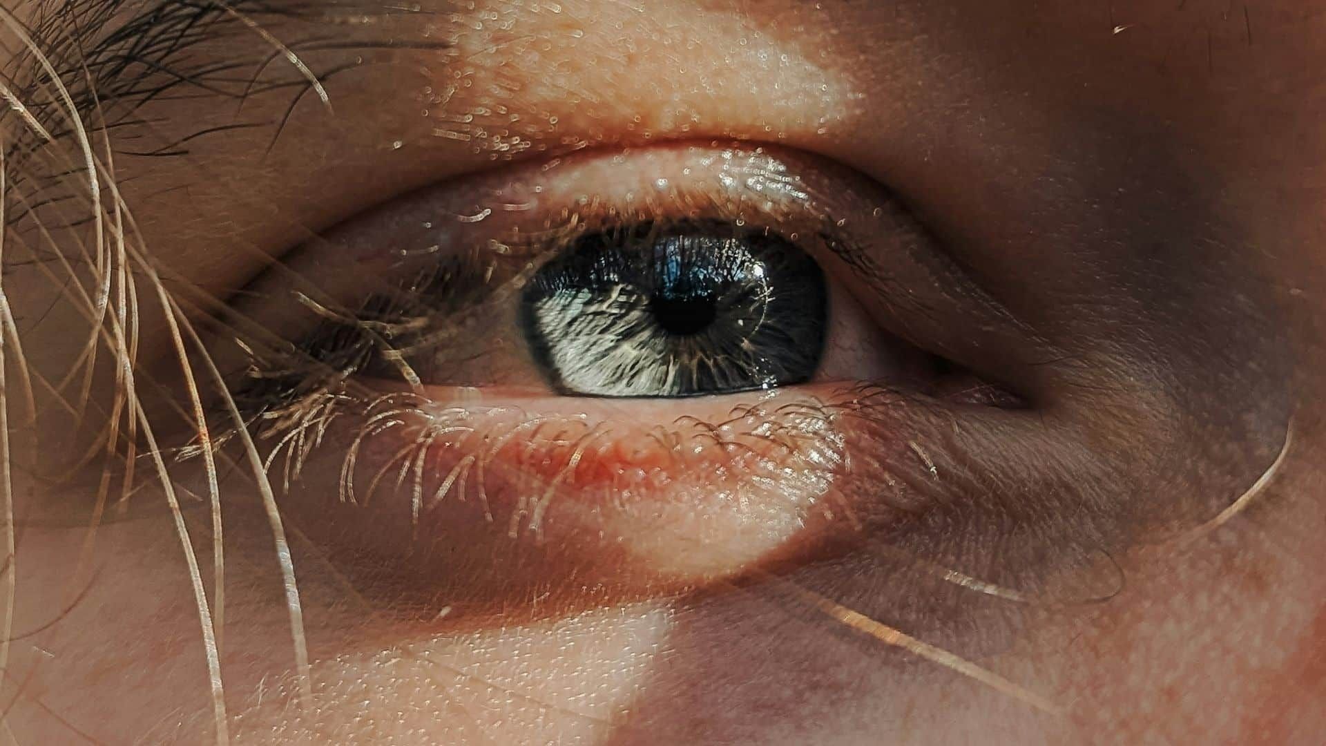 What Is Surfer’s Eye: Causes, Symptoms, And Prevention
