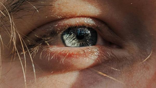 What Is Surfer’s Eye: Causes, Symptoms, And Prevention