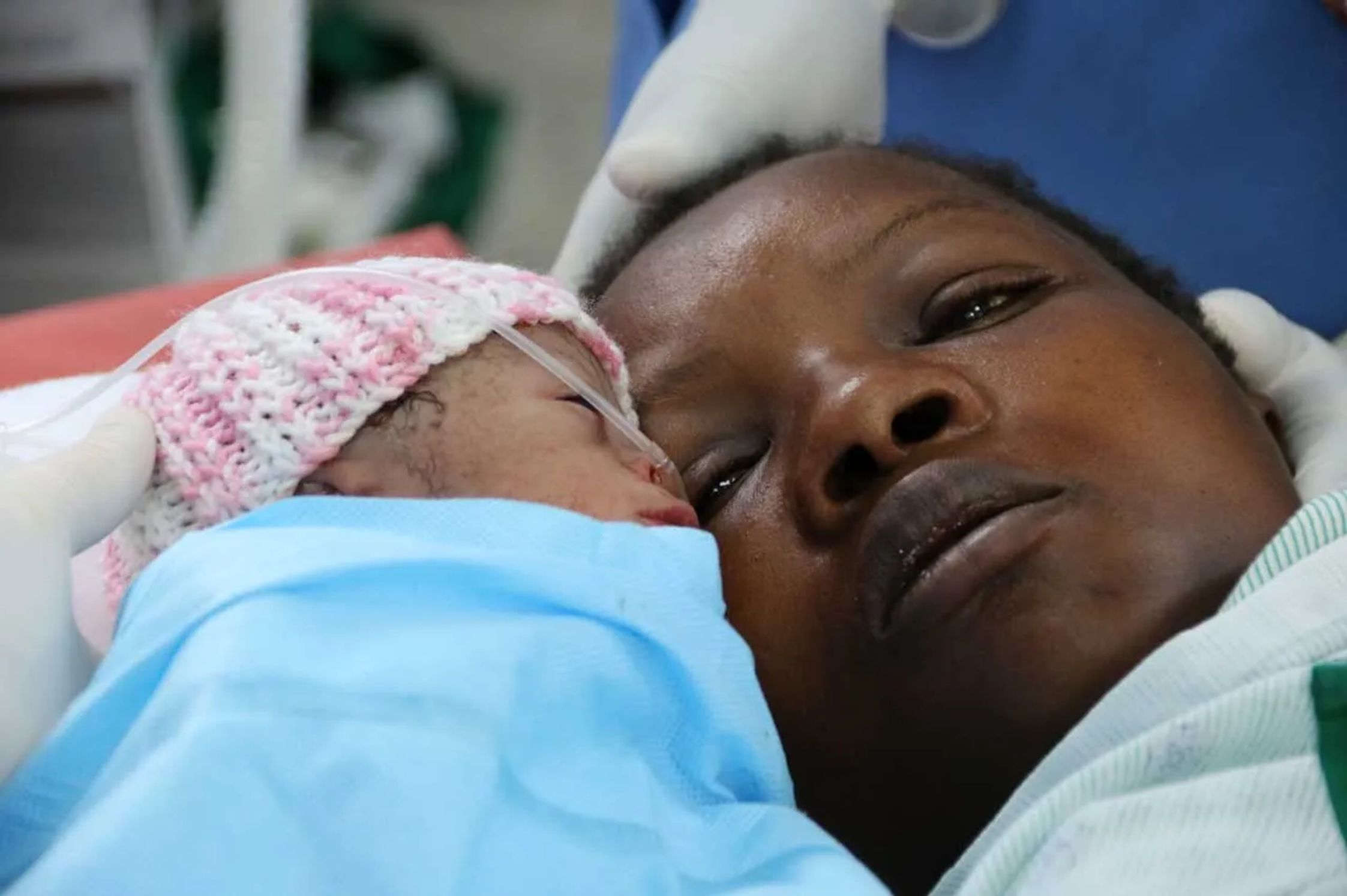 A close-up photo of a mother and her newborn with a breathing tube attached to their nose