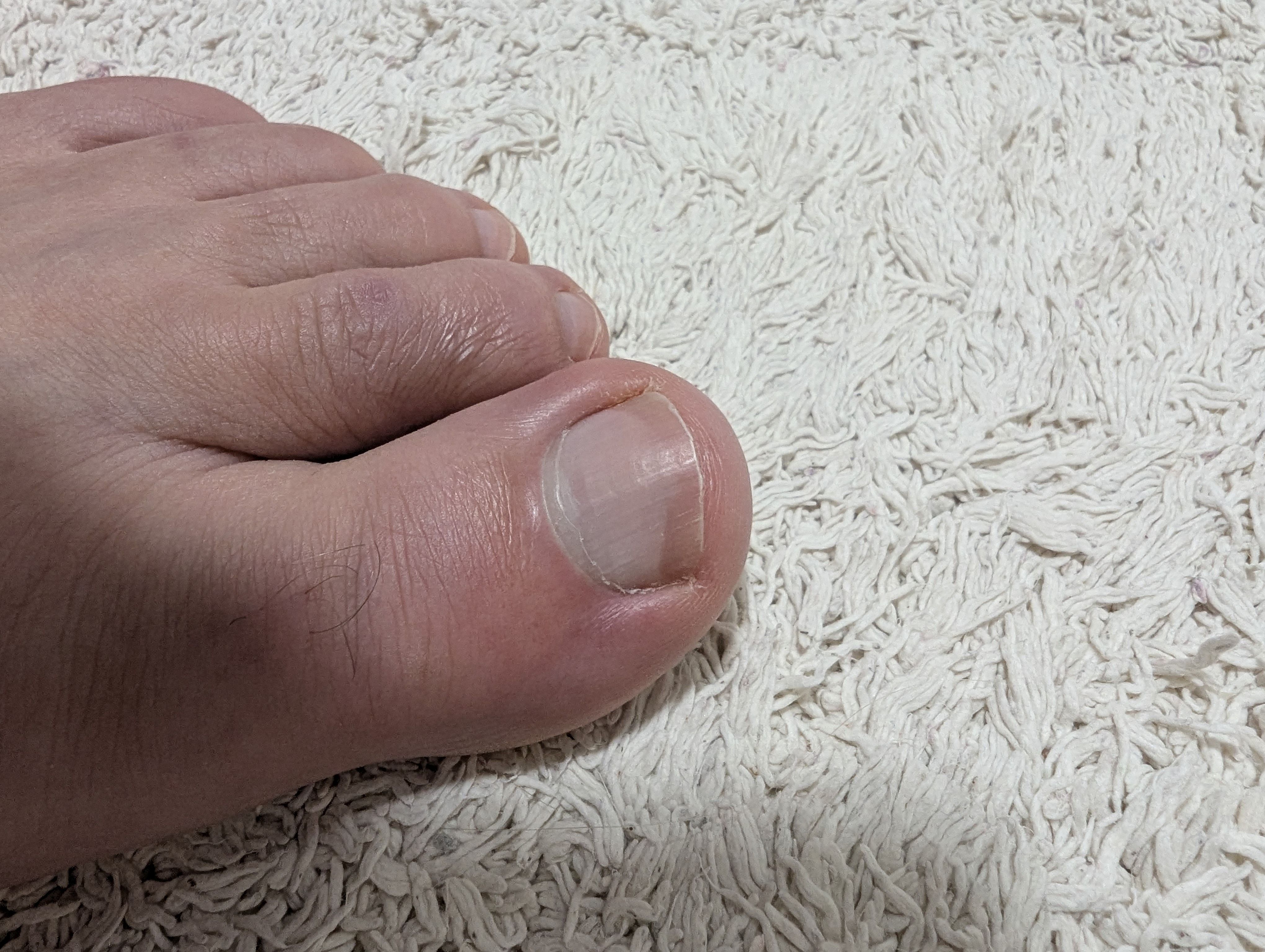 Diabetic Foot Check