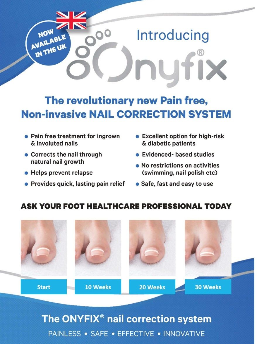 Onyfix Nail Correction System