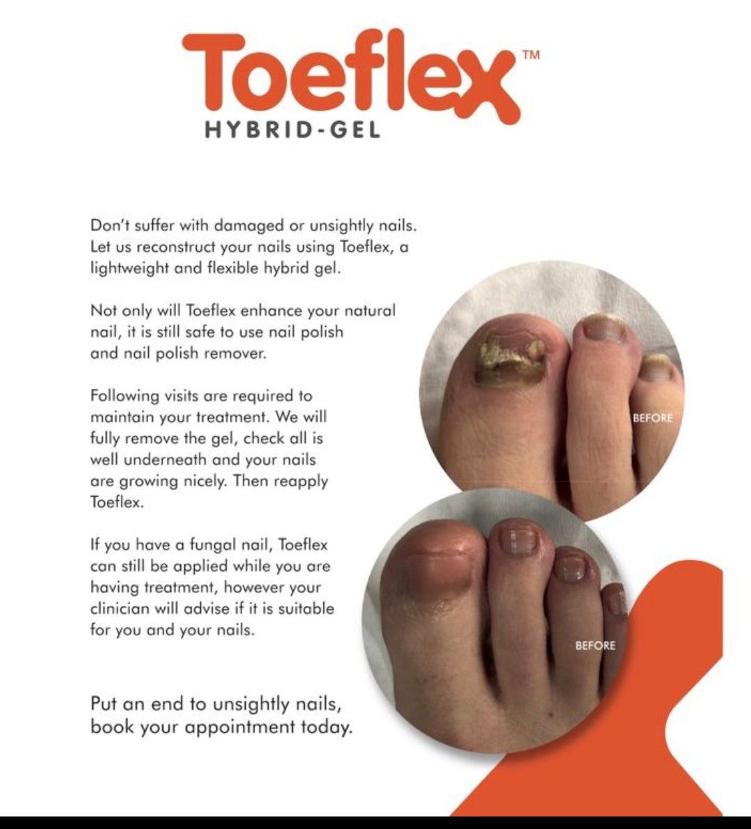 Toeflex Hybrid Gel