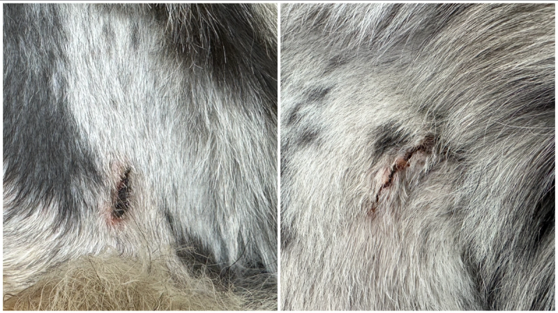 Day 8: Right side looks sealed, left side catching up, scabs thinning