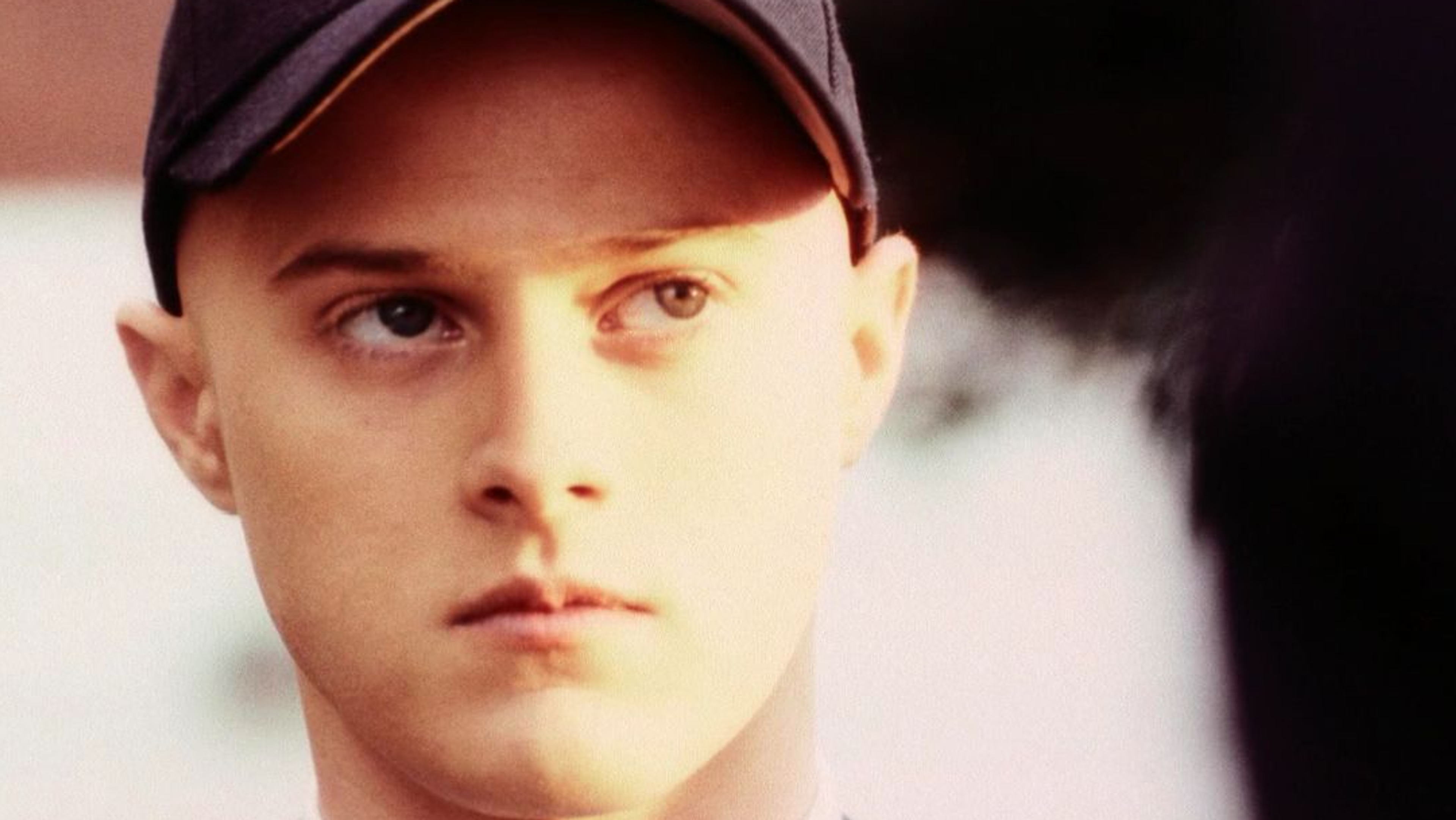 A teen wears a hat to hide his baldness.