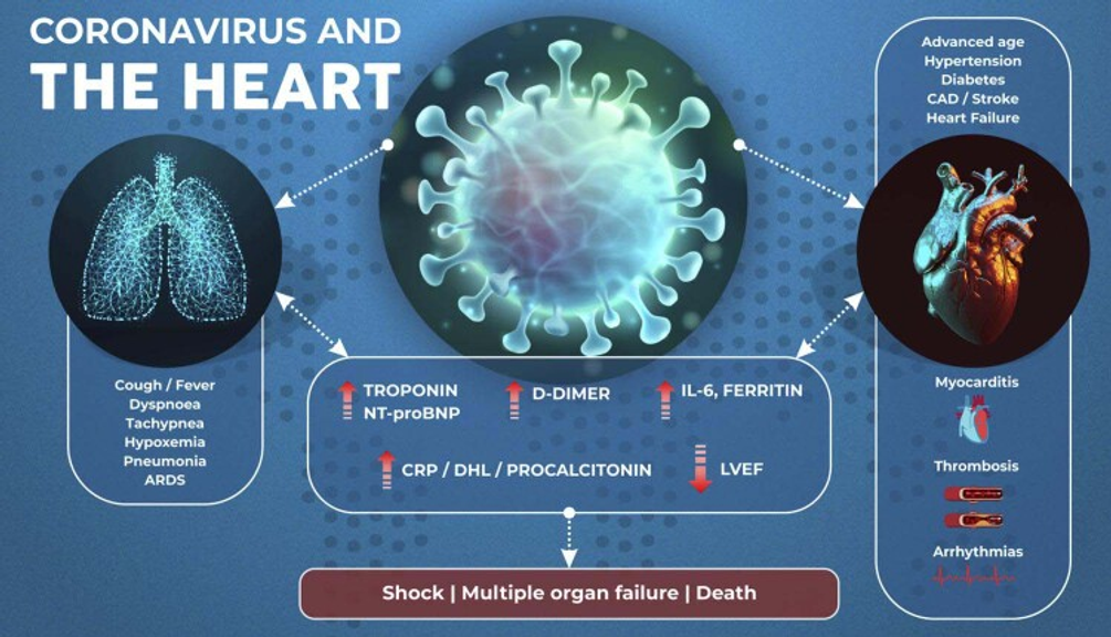 The Heart and COVID-19: What Cardiologists Need to Know