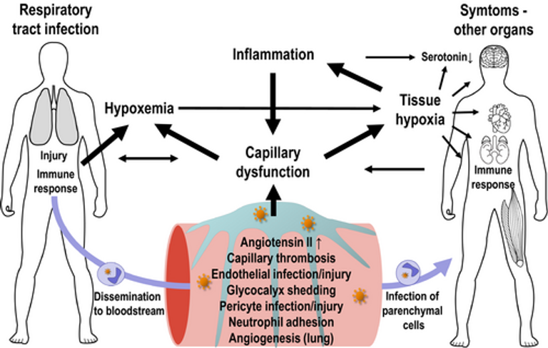 SARS CoV-2 related microvascular damage and symptoms during and after COVID-19: Consequences of capillary transit-time changes, tissue hypoxia and inflammation