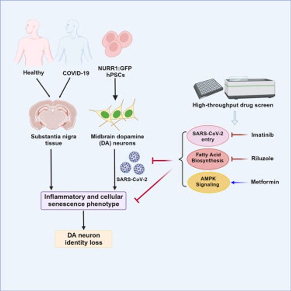 SARS-CoV-2 infection causes dopaminergic neuron senescence