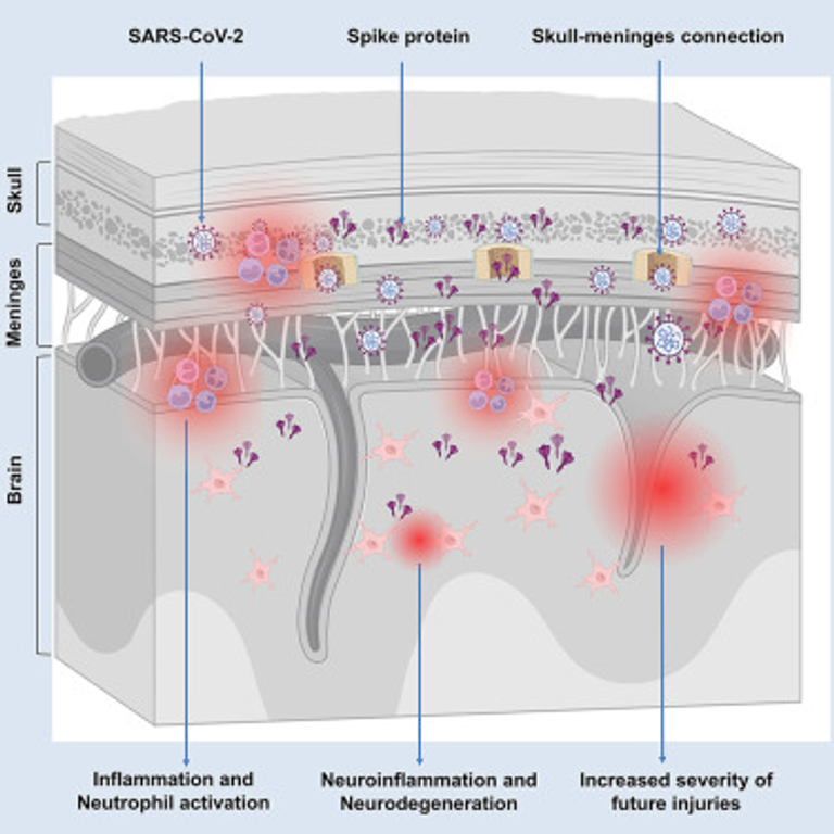 Persistence of spike protein at the skull-meninges-brain axis may contribute to the neurological sequelae of COVID-19