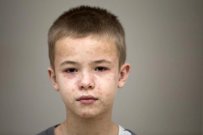 Pennsylvania tops 800 measles cases as CDC acknowledges only 1 measles death