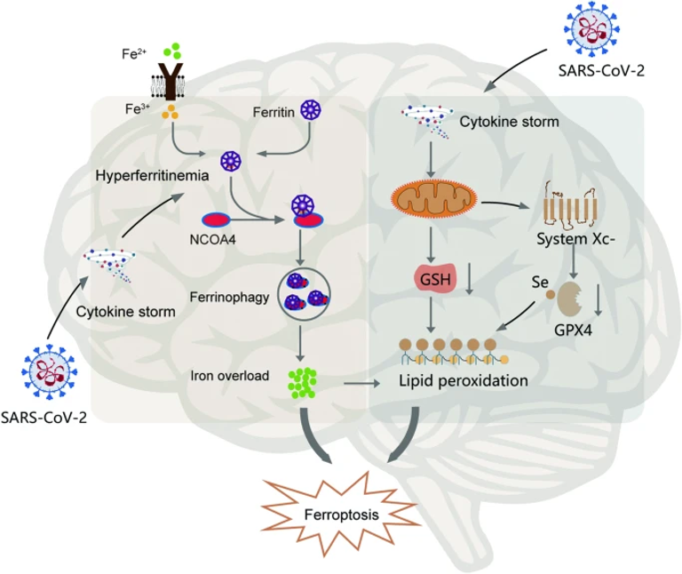 COVID-19 related neurological manifestations in Parkinson’s disease: has ferroptosis been a suspect?