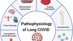Current status and future perspectives on the mechanistic and pathophysiological understanding of long COVID