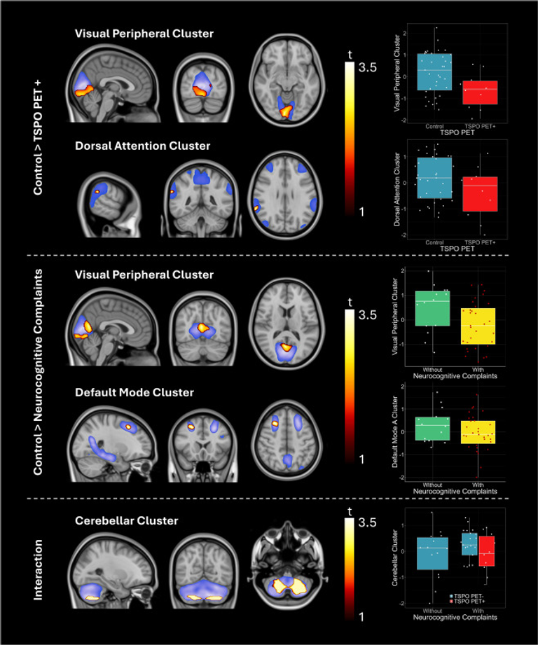 Decreased functional connectivity in post-COVID syndrome patients with high neuroinflammatory activity