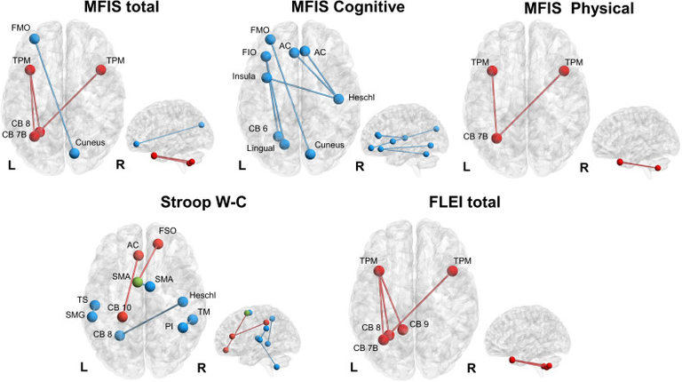 Neural basis of fatigue in post-COVID syndrome and relationships with cognitive complaints and cognition