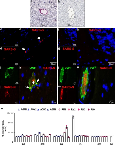 Neuropathology and virus in brain of SARS-CoV-2 infected non-human primates