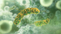 Cas de listériose: plusieurs autres malades signalés en Europe, une "épidémie internationale" liée aux fromages français