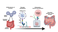 SARS-CoV-2 infection drives local inflammation of the intestinal epithelium in immunocompromised patients with cancer