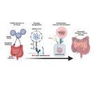 SARS-CoV-2 infection drives local inflammation of the intestinal epithelium in immunocompromised patients with cancer