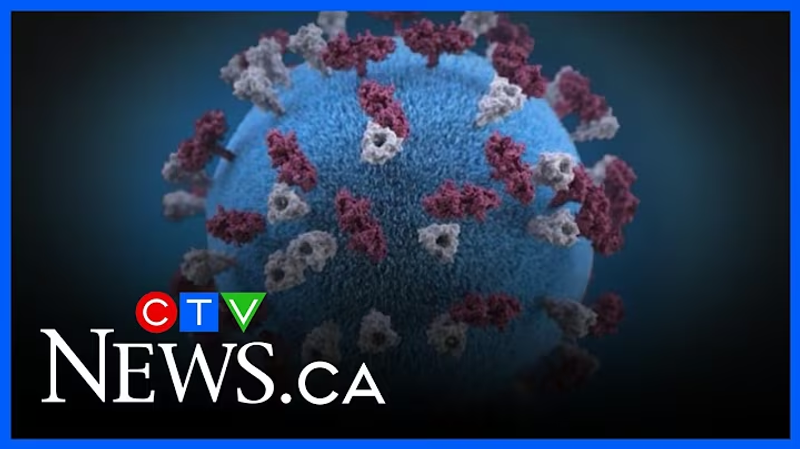 Multiple measles exposures reported in Manitoba