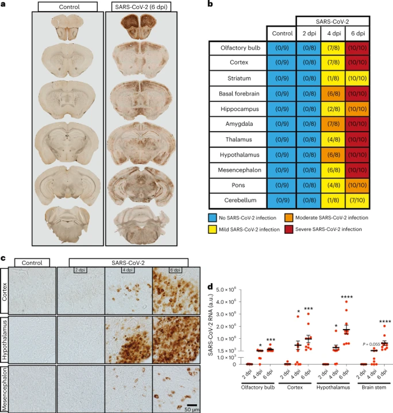 Full protection from SARS-CoV-2 brain infection and damage in susceptible transgenic mice conferred by MVA-CoV2-S vaccine candidate