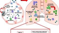COVID-19: a potential driver of immune-mediated breast cancer recurrence?
