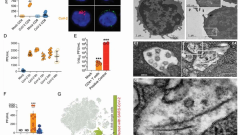 SARS-CoV-2 uses CD4 to infect T helper lymphocytes