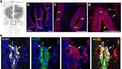 Long-COVID cognitive impairments and reproductive hormone deficits in men may stem from GnRH neuronal death