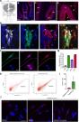 Long-COVID cognitive impairments and reproductive hormone deficits in men may stem from GnRH neuronal death