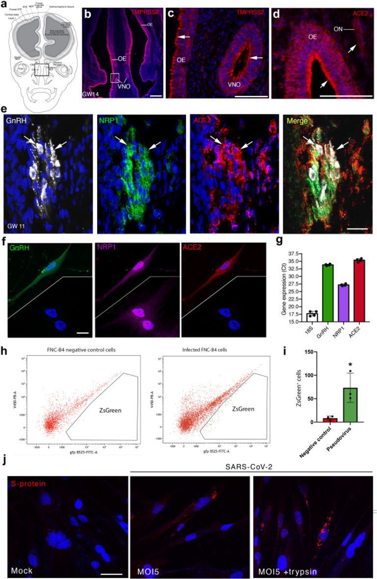 Long-COVID cognitive impairments and reproductive hormone deficits in men may stem from GnRH neuronal death