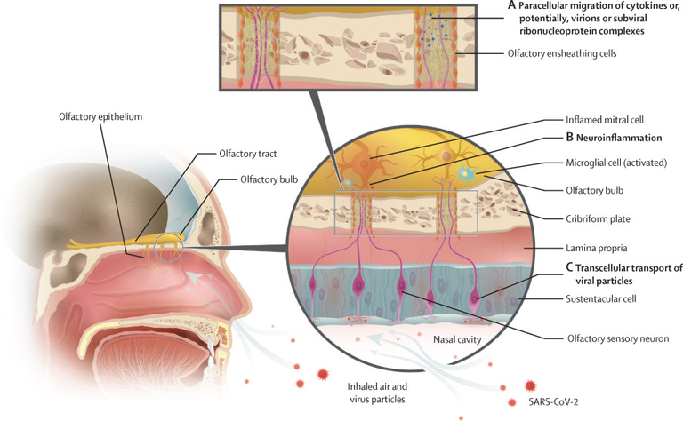 Post-viral effects of COVID-19 in the olfactory system and their implications