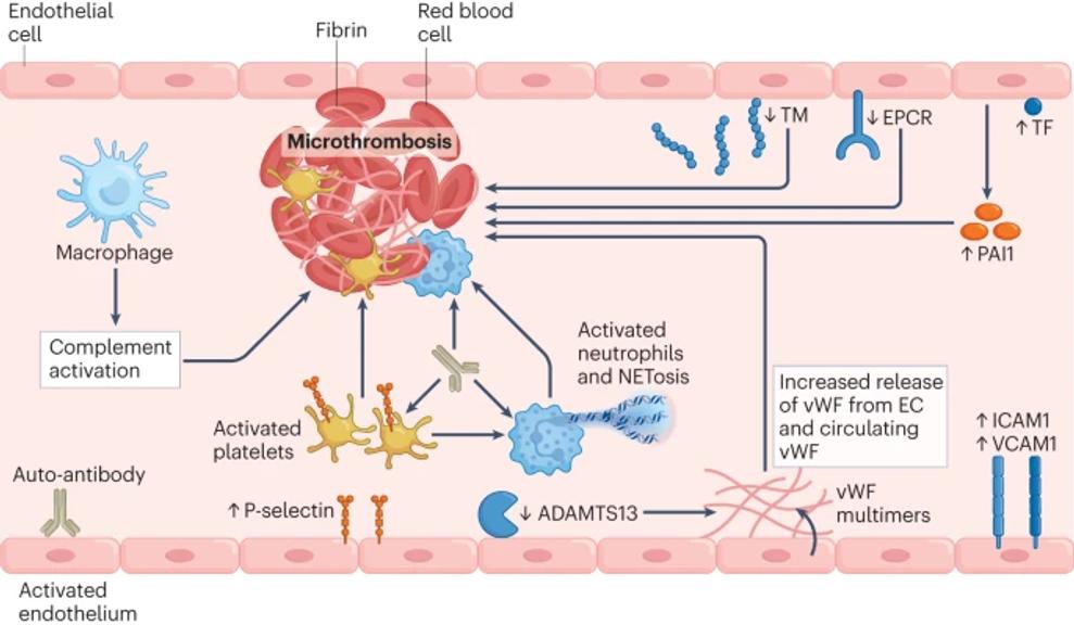 The immunology of long COVID