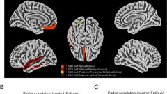 Morphological, cellular, and molecular basis of brain infection in COVID-19 patients