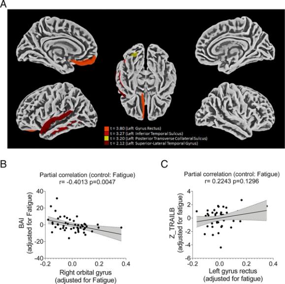 Morphological, cellular, and molecular basis of brain infection in COVID-19 patients