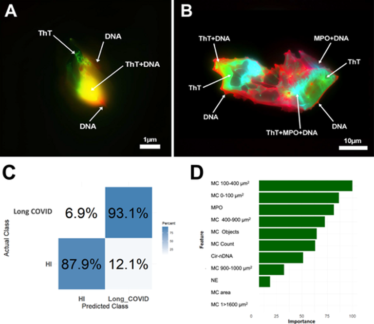 Circulating Microclots Are Structurally Associated With Neutrophil Extracellular Traps and Their Amounts Are Elevated in Long COVID Patients