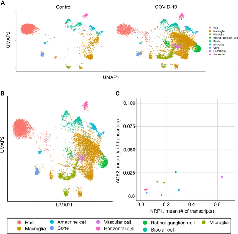 SARS-CoV-2 induces Alzheimer’s disease–related amyloid-β pathology in ex vivo human retinal explants and retinal organoids