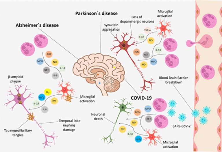 Neuroinflammation and Oxidative Stress in Parkinson’s Disease, Alzheimer’s Disease, and COVID-19: Microglia–Neutrophil Interaction