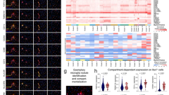 High throughput spatial immune mapping reveals an innate immune scar in post-COVID-19 brains