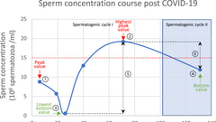 SARS-CoV-2 infection reduces quality of sperm parameters: prospective one year follow-up study in 93 patients