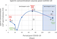 SARS-CoV-2 infection reduces quality of sperm parameters: prospective one year follow-up study in 93 patients