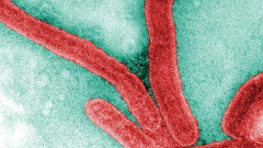 Death toll climbs in Ethiopia's Marburg outbreak