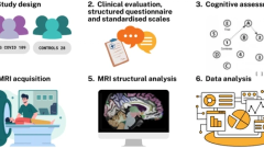 Cognitive impact and brain structural changes in long COVID patients: a cross-sectional MRI study two years post infection in a cohort from Argentina