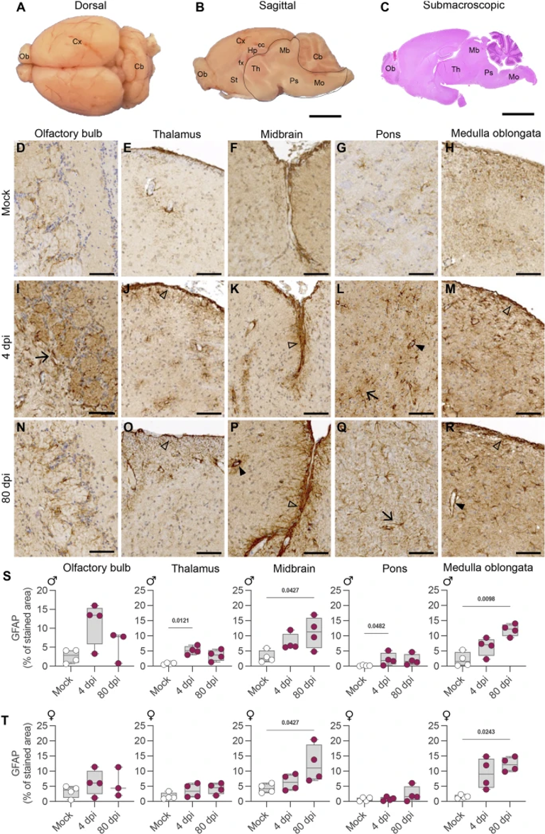 Hamsters with long COVID present distinct transcriptomic profiles associated with neurodegenerative processes in brainstem