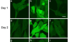 Near-Infrared Light Exposure Triggers ROS to Downregulate Inflammatory Cytokines Induced by SARS-CoV-2 Spike Protein in Human Cell Culture