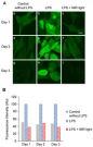 Near-Infrared Light Exposure Triggers ROS to Downregulate Inflammatory Cytokines Induced by SARS-CoV-2 Spike Protein in Human Cell Culture