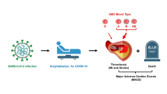 COVID-19 Is a Coronary Artery Disease Risk Equivalent and Exhibits a Genetic Interaction With ABO Blood Type
