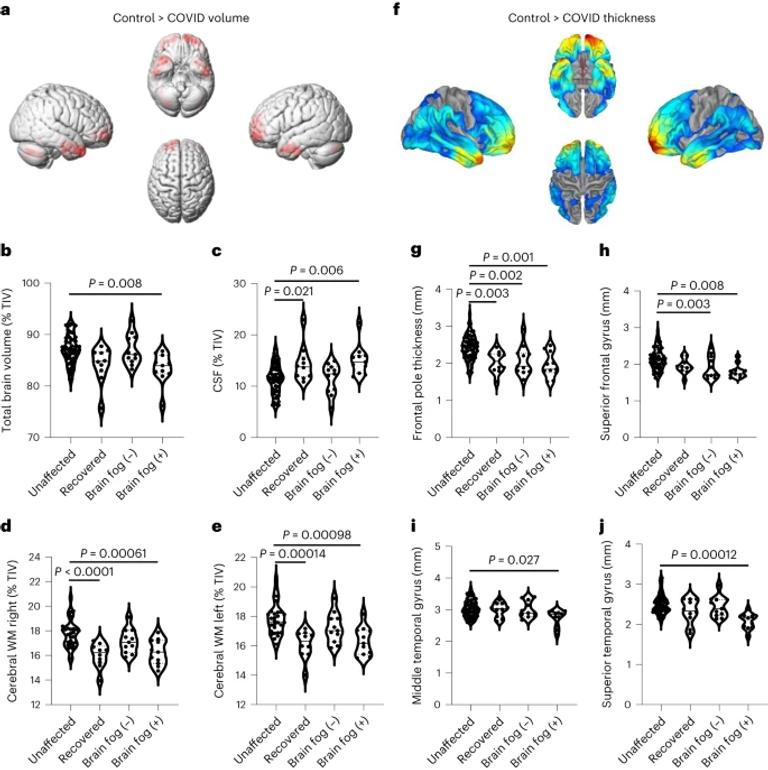 Blood–brain barrier disruption and sustained systemic inflammation in individuals with long COVID-associated cognitive impairment