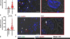 Pulmonary inflammation and viral replication define distinct clinical outcomes in fatal cases of COVID-19