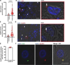 Pulmonary inflammation and viral replication define distinct clinical outcomes in fatal cases of COVID-19