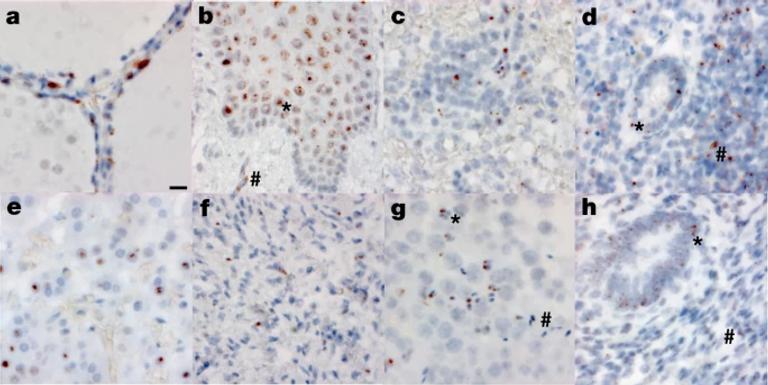 SARS-CoV-2 infection and persistence in the human body and brain at autopsy